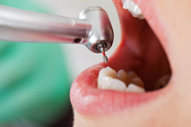 Best Pediatric Emergency Dentist in Zapata, TX